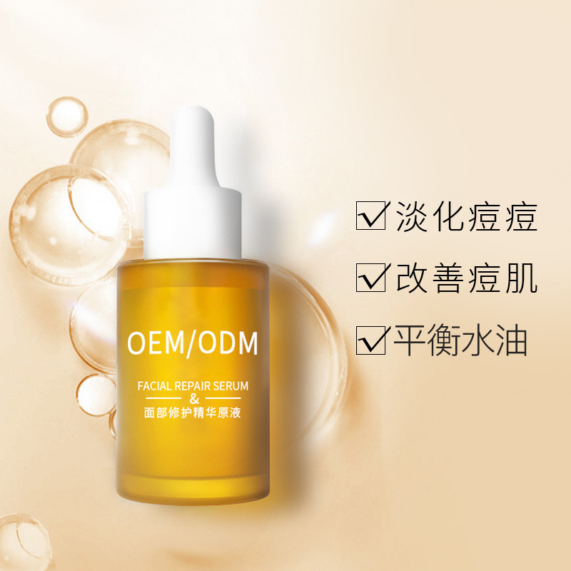 郑州市_祛痘精华原液OEM